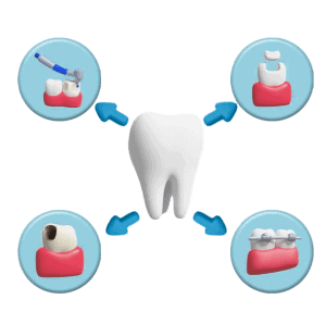 Full-mouth rehabilitation treatment plan